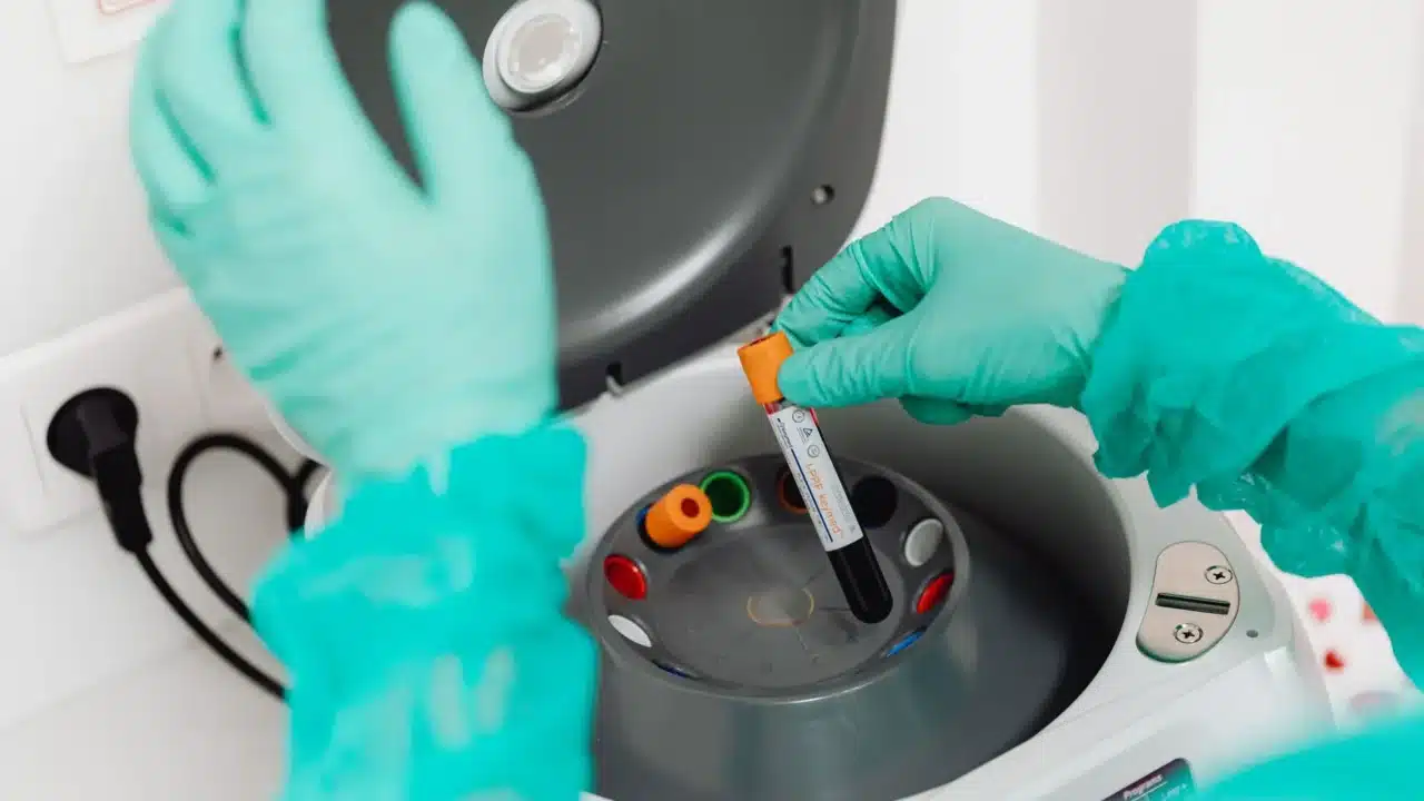 Medical Test Lab Sample