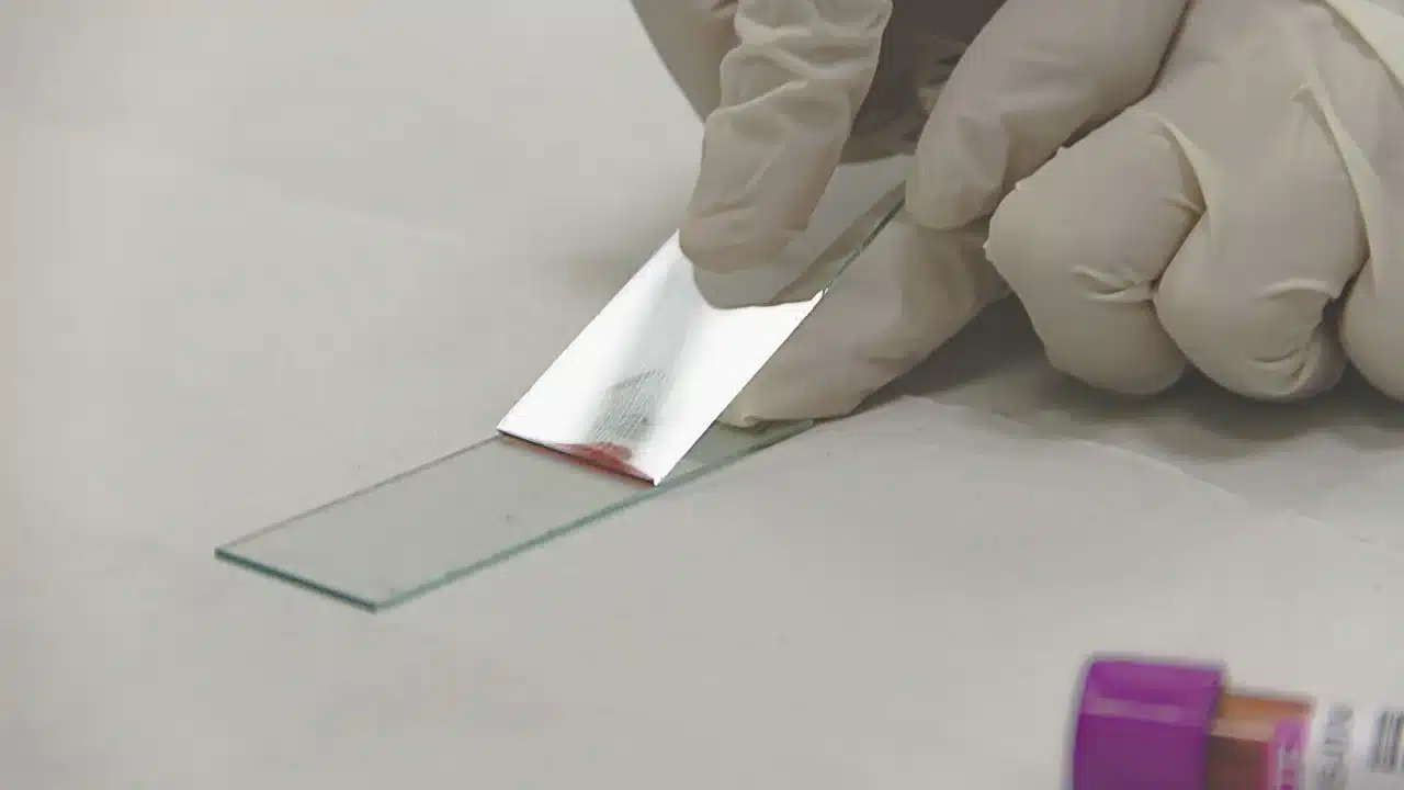 Herpes Genital Jangka Panjang: Gejala, Penyebab & Solusi 4 microscope blood test
