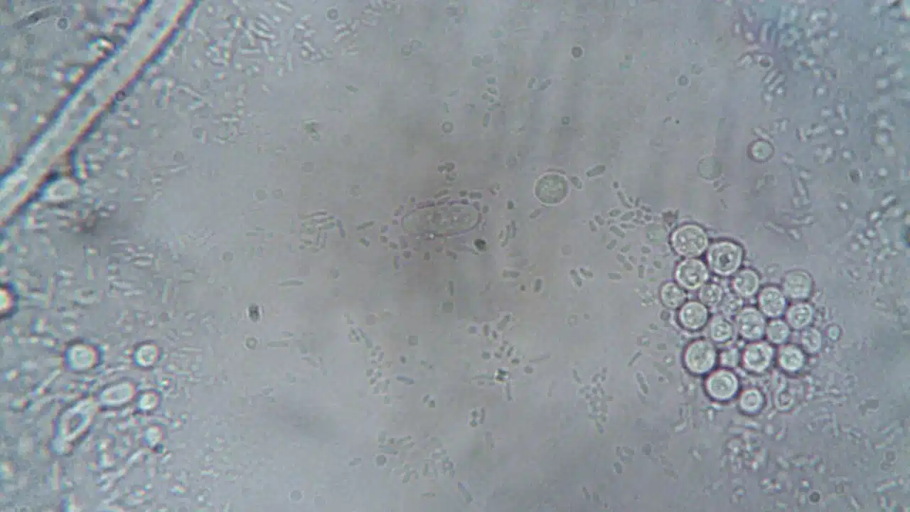 Parasit Penyebab Malaria: Jenis, Siklus, dan Bahayanya 1 microscope cell blood parasite