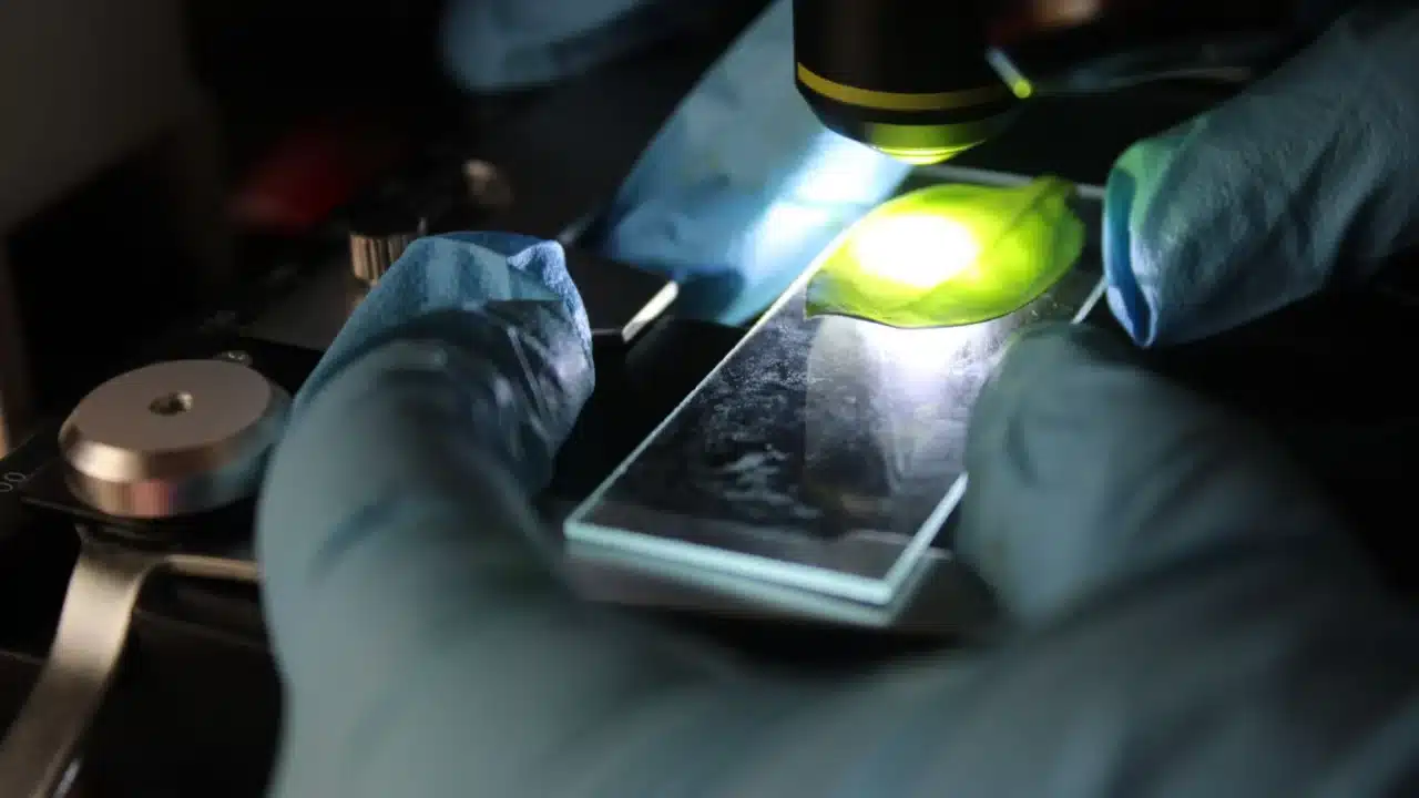 Cara Mendiagnosis Kanker Serviks dan Prosedur Medisnya 2 microscope slide medical clinic