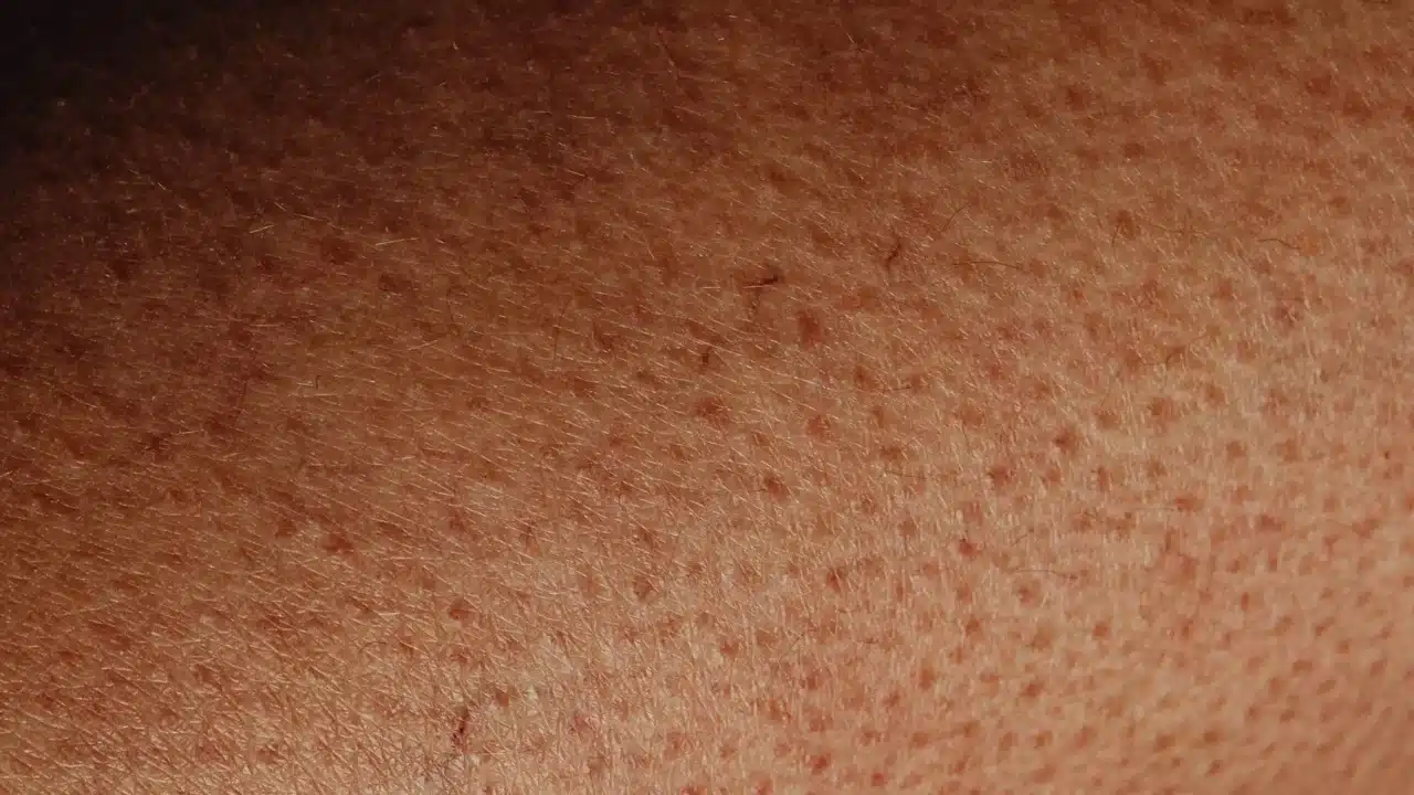 Red Rash Skin Bumps Bad Odor