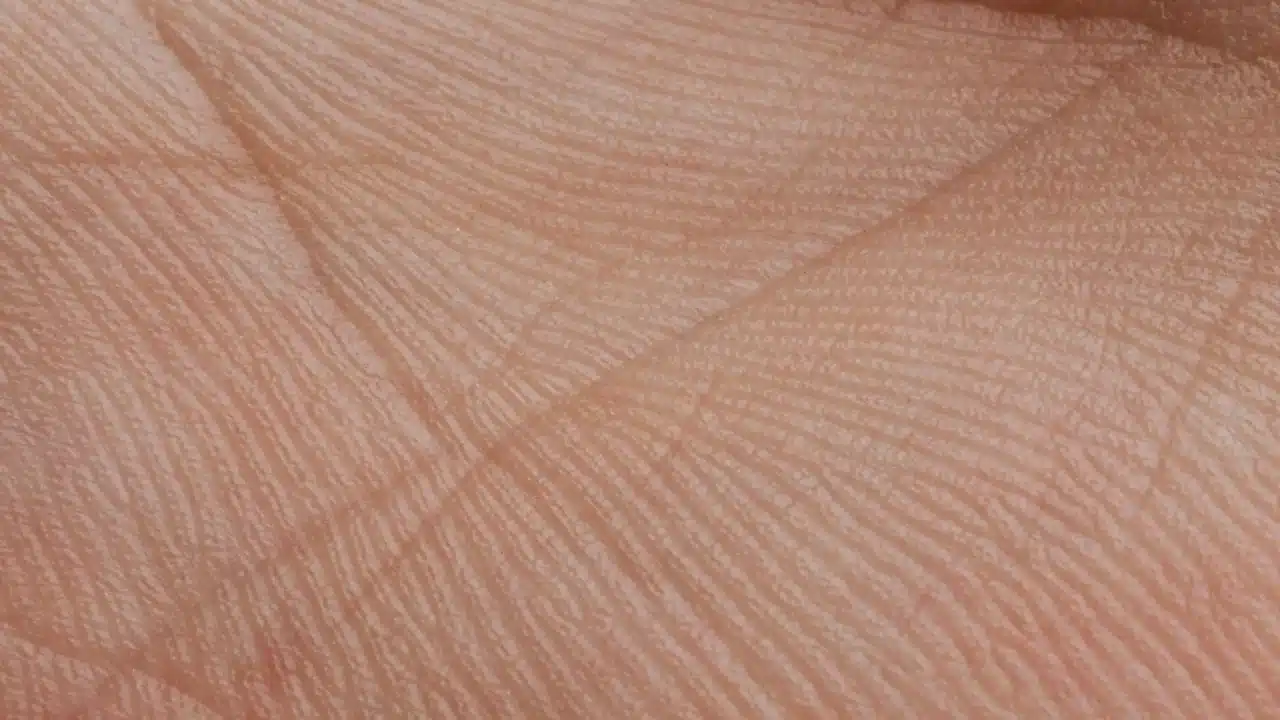 skin texture dermatologist