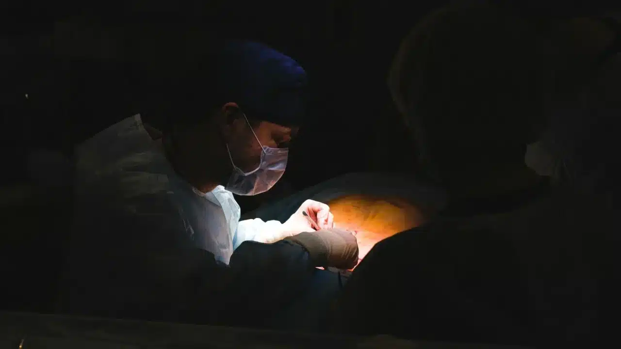 Abses Perianal & Fistula Ani: Penyebab, Gejala, Pengobatan 2 Surgery Doctor Hospital