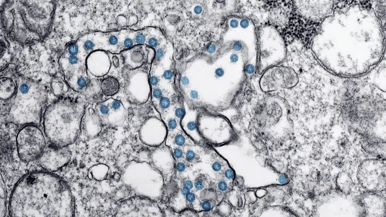 virus microscope