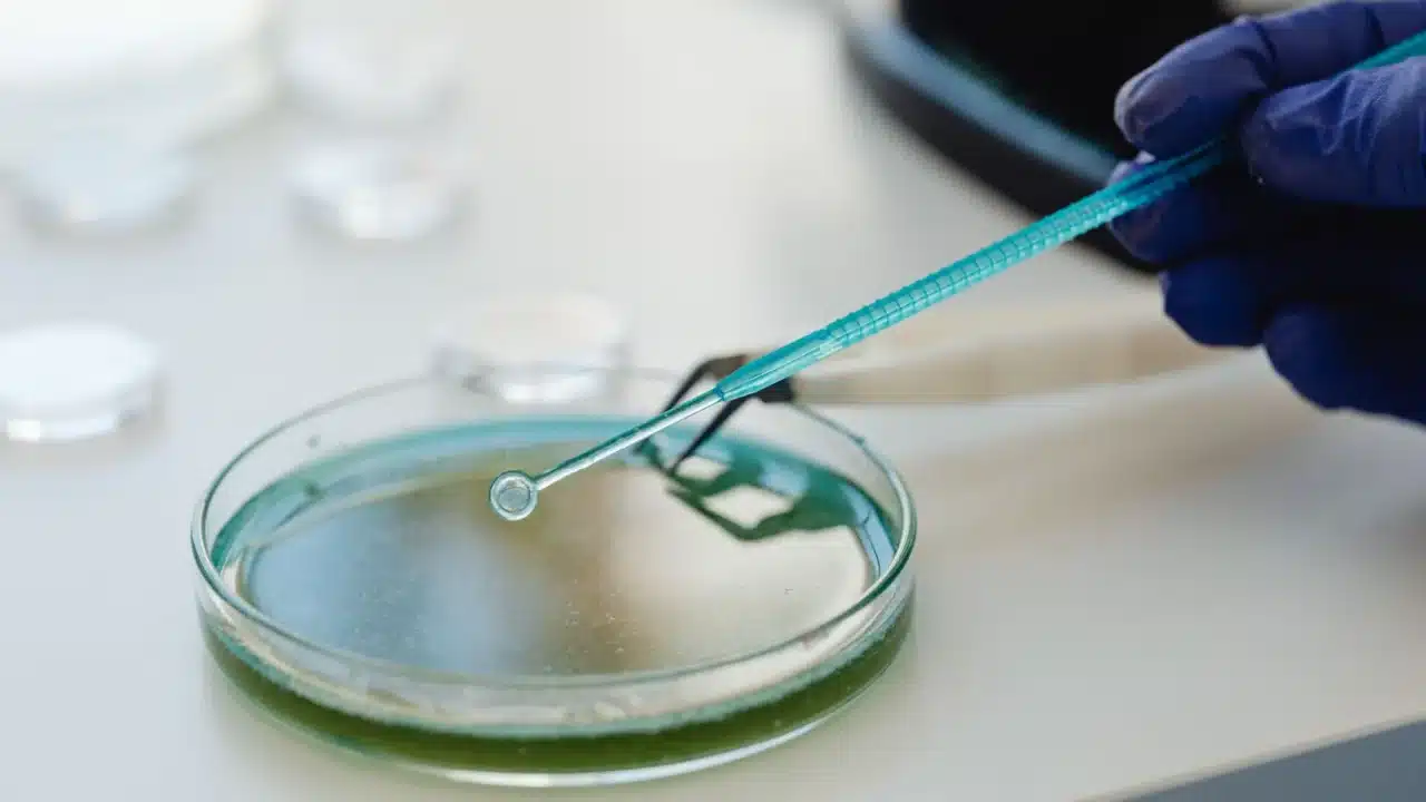 Bedanya Sifilis dan Gonore: Gejala, Penyebab, dan Obat 2 bacteria microscope laboratory test