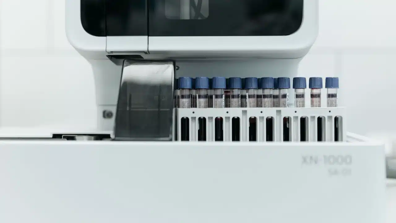 Mati Rasa Penyebab Lumpuh: Gejala, Penyebab, dan Penanganan 4 blood test nerve cells