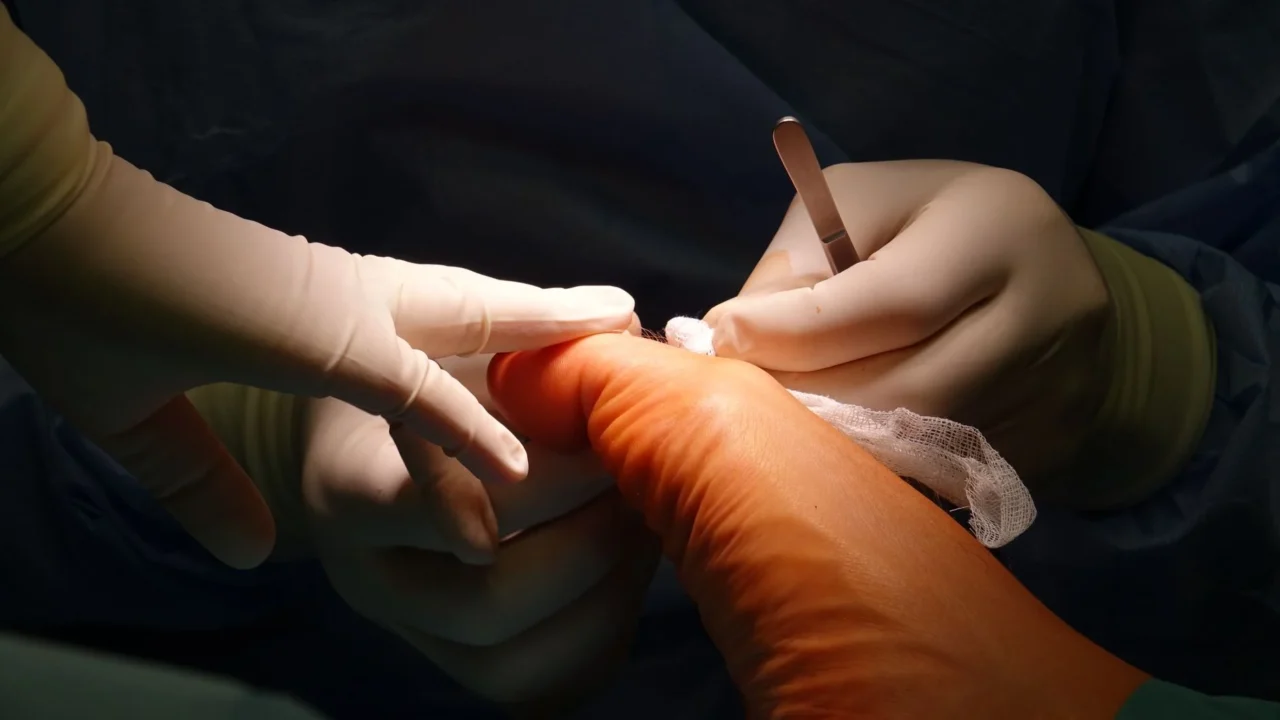 Gejala Asam Urat di Kaki: Ciri, Penyebab, dan Cara Mengobati 1 foot joint bone structure