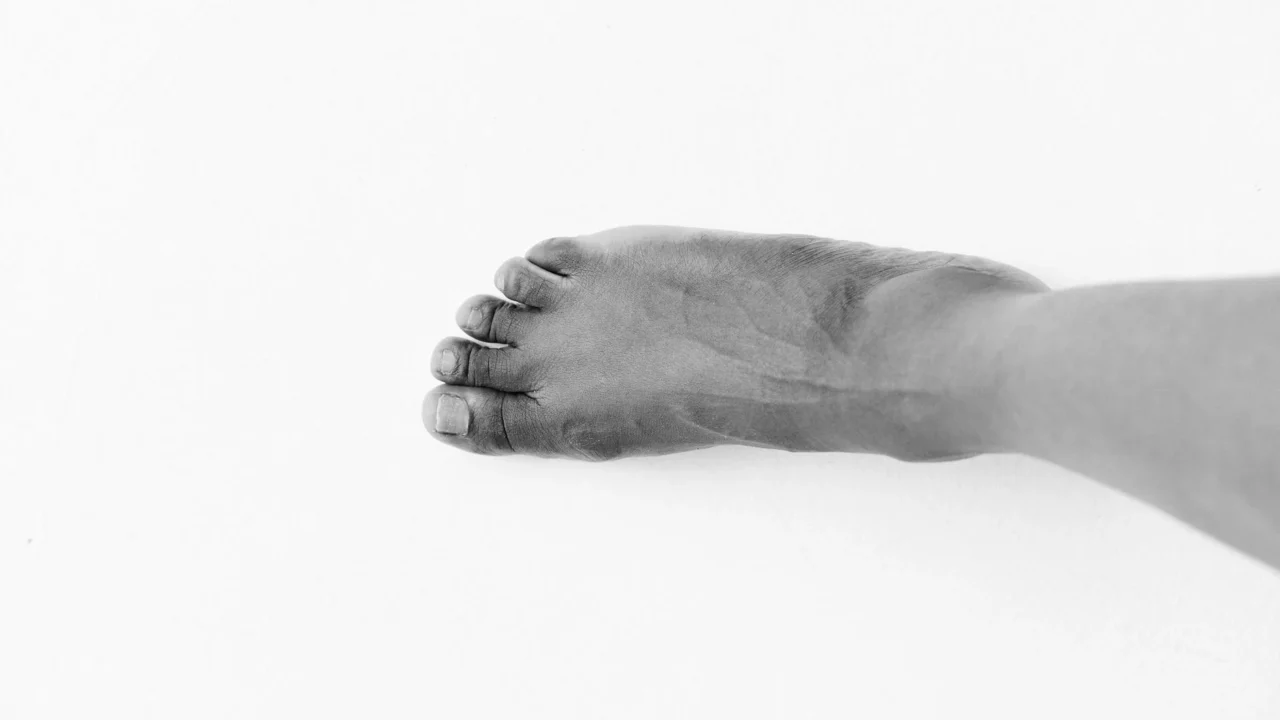 Gejala Asam Urat di Kaki: Ciri, Penyebab, dan Cara Mengobati 3 human foot joint inflammation