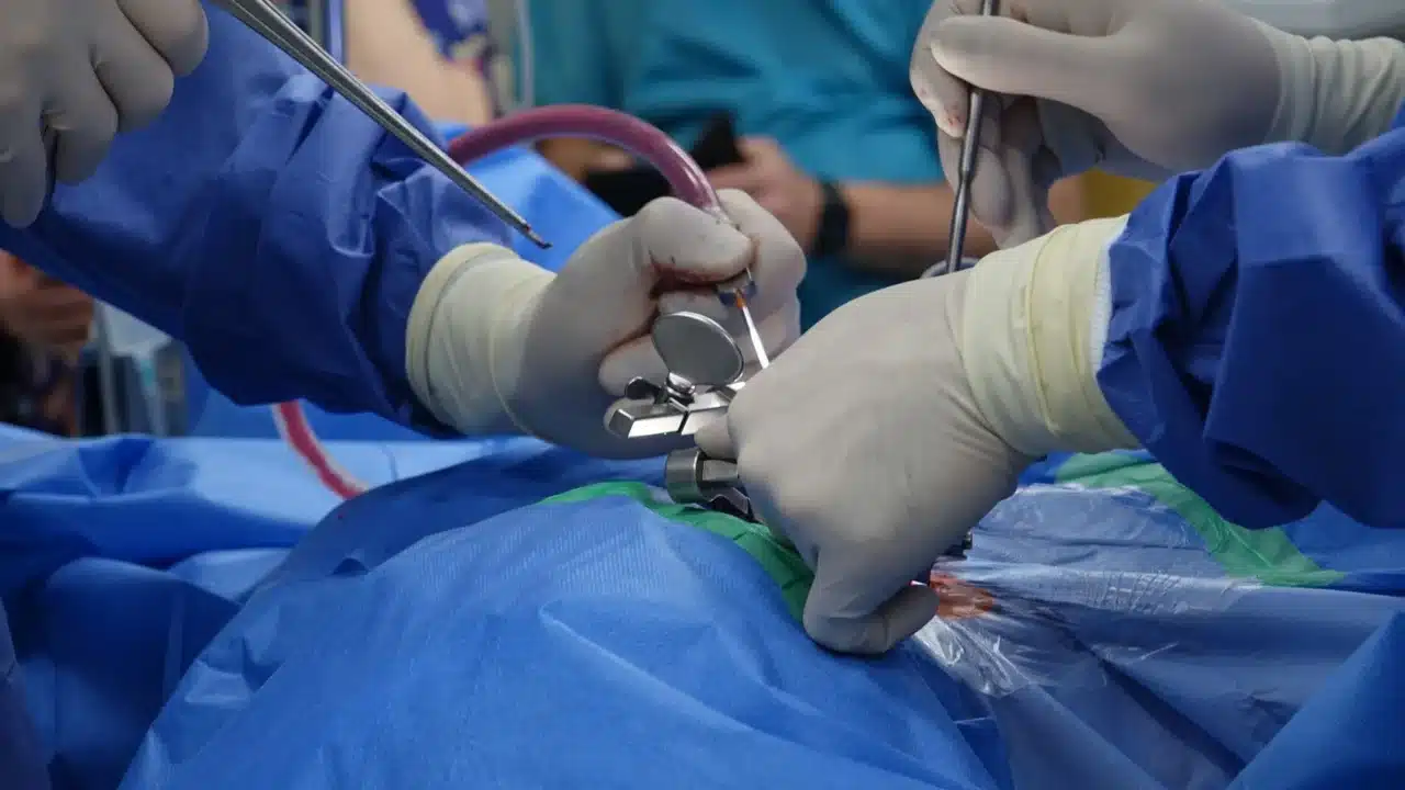 Mati Rasa Penyebab Lumpuh: Gejala, Penyebab, dan Penanganan 1 human spine doctor