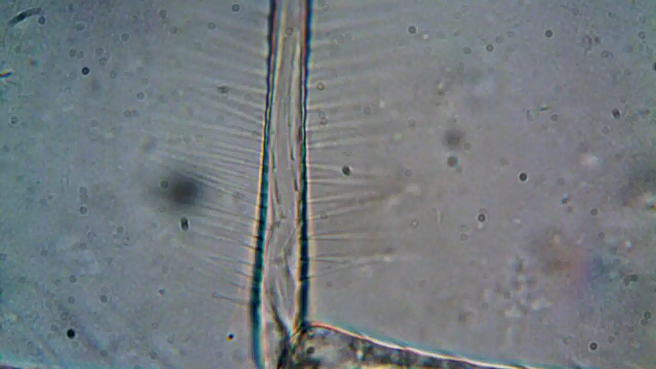 Apa itu Kanker Ovarium: Gejala, Penyebab, dan Penanganan 2 microscope cell laboratory research