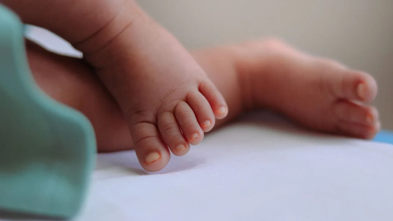 Gejala Asam Urat di Kaki: Ciri, Penyebab, dan Cara Mengobati 2 swollen foot toe pain